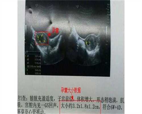 供卵试管
